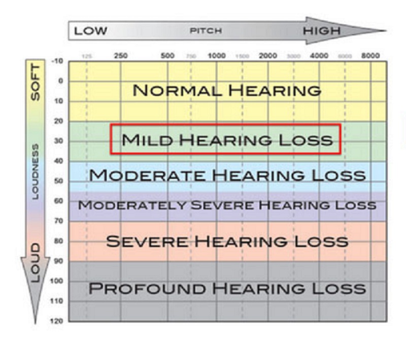 define precipitate hearing loss